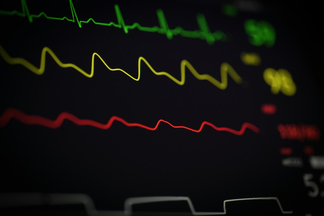 Close-up view of a medical monitor displaying heart rate and vital signs.